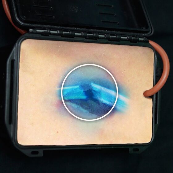 K9 Shrapnel Wound in a Box - North American Rescue®